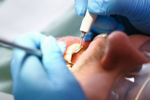 Best Orthodontic Emergency Dentist in Lexington, MO