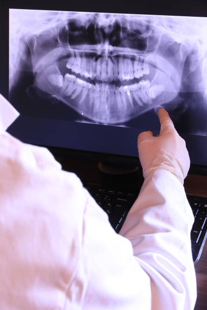 Best Emergency Dentist for Knocked-Out Tooth in Lexington, MO