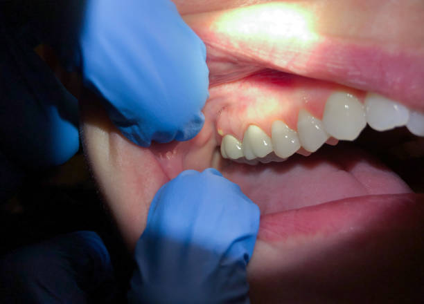 , MO Emergency Dentist Company