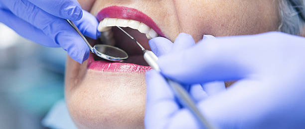 Best Emergency Dental Extractions in Lexington, MO